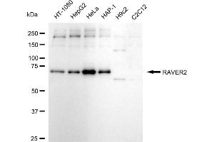 Western blotting analysis using RAVER2 antibody (ABIN7800211). (Recombinant RAVER2 抗体)