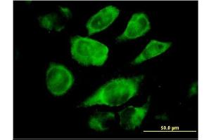 Immunofluorescence of monoclonal antibody to SSR4 on HeLa cell. (SSR4 抗体  (AA 24-173))