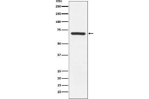 Western blot analysis of MEKK3 expression in Hela cell lysate.