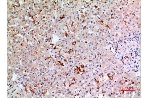Immunohistochemistry (IHC) analysis of paraffin-embedded Human Liver, antibody was diluted at 1:100. (CYBB 抗体  (Internal Region))