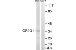 Western blot analysis of extracts from MCF-7 cells, using OR9Q1 Antibody. (OR9Q1 抗体  (AA 234-283))
