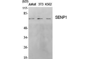 Western Blot analysis of various cells using SENP1 Polyclonal Antibody.