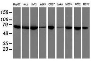 Image no. 2 for anti-Dystrobrevin, beta (DTNB) antibody (ABIN1497915) (Dystrobrevin beta 抗体)