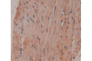 IHC-P analysis of Human Tissue, with DAB staining. (TNNI1 抗体  (AA 1-187))