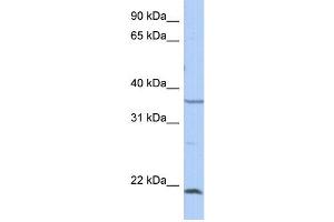 WB Suggested Anti-SPRY2 Antibody Titration: 0. (SPRY2 抗体  (Middle Region))