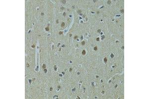 Immunohistochemistry of paraffin-embedded rat brain using UBE2I antibody. (UBE2I 抗体  (AA 1-158))