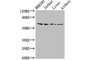 Western Blot Positive WB detected in: HEK293 whole cell lysate, Jurkat whole cell lysate, Rat liver tissue, Rat kidney tissue All lanes: TXK antibody at 3 μg/mL Secondary Goat polyclonal to rabbit IgG at 1/50000 dilution Predicted band size: 62 kDa Observed band size: 62 kDa (TXK 抗体  (AA 32-83))
