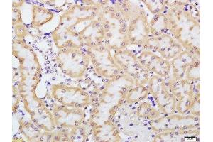 Paraformaldehyde-fixed, paraffin embedded rat kidney tissue, Antigen retrieval by boiling in sodium citrate buffer(pH6) for 15min, Block endogenous peroxidase by 3% hydrogen peroxide for 30 minutes, Blocking buffer (normal goat serum) at 37°C for 20min, Antibody incubation with Rabbit Anti-beta defensin 1 Polyclonal Antibody, Unconjugated  at 1:200 overnight at 4°C, followed by a conjugated secondary and DAB staining (beta Defensin 1 抗体  (AA 33-68))