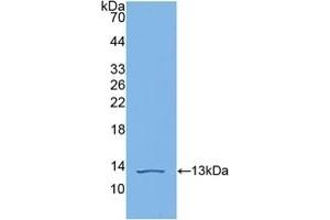 Detection of Recombinant C4b, Human using Polyclonal Antibody to Complement C4-B (C4B) (C4B 抗体  (AA 680-756))