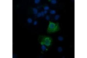 Image no. 3 for anti-Trafficking Protein Particle Complex 4 (TRAPPC4) antibody (ABIN1501263)