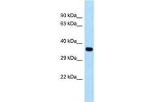 Image no. 1 for anti-Cysteinyl Leukotriene Receptor 1 (CYSLTR1) (AA 199-248) antibody (ABIN6747993)