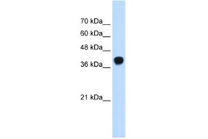 WB Suggested Anti-SQLE Antibody Titration: 0. (SQLE 抗体  (C-Term))