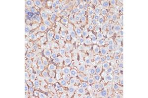 Immunohistochemistry of paraffin-embedded mouse liver using  antibody (ABIN6129926, ABIN6136997, ABIN6136998 and ABIN6218500) at dilution of 1:100 (40x lens). (APOA1 抗体  (AA 25-267))