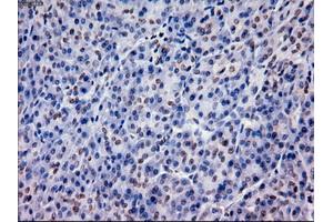 Immunohistochemistry (IHC) image for anti-Epithelial Cell Adhesion Molecule (EPCAM) (AA 24-265) antibody (ABIN1491254) (EpCAM 抗体  (AA 24-265))