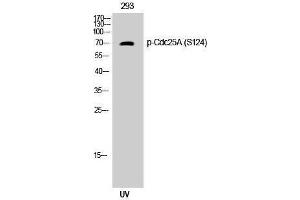 Western Blotting (WB) image for anti-Cell Division Cycle 25 Homolog A (S. Pombe) (CDC25A) (pSer124) antibody (ABIN3179540) (CDC25A 抗体  (pSer124))