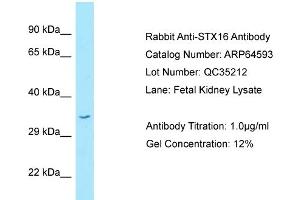 Western Blotting (WB) image for anti-Syntaxin 16 (STX16) (C-Term) antibody (ABIN2789888) (Syntaxin 16 抗体  (C-Term))