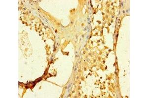 Immunohistochemistry of paraffin-embedded human testis tissue using ABIN7170528 at dilution of 1:100 (SPATS1 抗体  (AA 1-300))