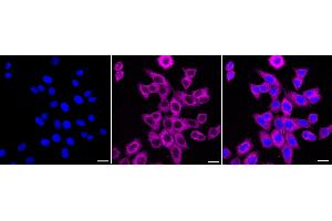 Immunocytochemical staining of HepG2 cells with MALT1 antibody (ABIN7799491), 1:1,000).