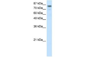 SMARCA3 antibody (20R-1090) used at 0. (HLTF 抗体  (N-Term))