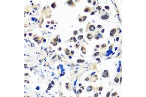 Immunohistochemistry (IHC) image for anti-Cullin-Associated and Neddylation-Dissociated 1 (CAND1) (AA 750-980) antibody (ABIN7266546)