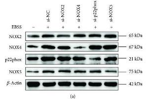 Western Blotting (WB) image for anti-Cytochrome B-245, beta Polypeptide (CYBB) (AA 283-570) antibody (ABIN3022300)