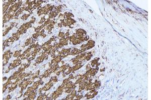 ABIN6277429 at 1/100 staining Human gastric tissue by IHC-P. (Peroxiredoxin 3 抗体  (Internal Region))