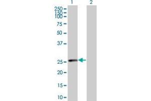 Lane 1: RAD51L3 transfected lysate ( 23. (RAD51L3 293T Cell Transient Overexpression Lysate(Denatured))