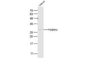 Mouse uterus lysates probed with TMEPAI Polyclonal Antibody, Unconjugated  at 1:300 dilution and 4˚C overnight incubation. (PMEPA1 抗体  (AA 21-120))