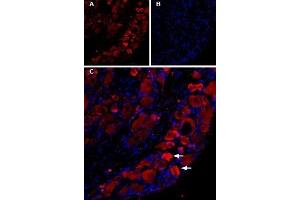Expression of TRPV1 in rat DRGs - Immunohistochemical staining of TRPV1 in rat dorsal root ganglion (DRG) using Guinea pig Anti-TRPV1 (VR1) Antibody (ABIN7043840, ABIN7045432 and ABIN7045433), (1:200). (TRPV1 抗体  (C-Term, Intracellular))