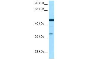 WB Suggested Anti-Asl Antibody Titration: 1. (ASL 抗体  (C-Term))