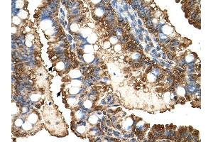 PGK1 antibody was used for immunohistochemistry at a concentration of 4-8 ug/ml to stain Epithelial cells of intestinal villus (arrows) in Human Intestine. (PGK1 抗体  (C-Term))