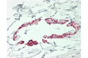 Human Small Intestine, Lymphatic Channel: Formalin-Fixed, Paraffin-Embedded (FFPE). (CCL21 抗体  (AA 24-134) (Biotin))