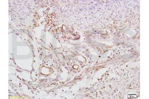 Formalin-fixed and paraffin embedded mouse uterus tissue labeled with Anti-Defensin-beta2/DEFB2/HBD-2 Polyclonal Antibody, Unconjugated (ABIN674574) at 1:200 followed by conjugation to the secondary antibody and DAB staining (beta 2 Defensin 抗体  (AA 21-71))
