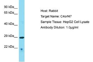 Host: Rabbit Target Name: C4orf47 Sample Type: HepG2 Whole Cell lysates Antibody Dilution: 1. (C4ORF47 抗体  (C-Term))