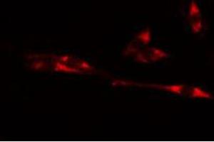 ABIN6274481 staining Hela cells by IF/ICC. (Cyclin-Dependent Kinase 15 (ALS2CR7) (Internal Region) 抗体)