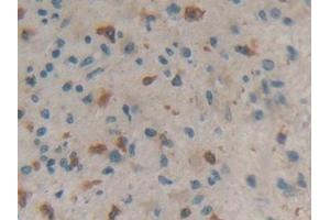 Immunohistochemistry (IHC) image for anti-Coronin, Actin Binding Protein, 1A (CORO1A) (AA 7-204) antibody (ABIN7436672)