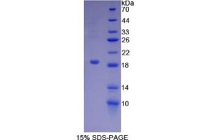 SDS-PAGE of Protein Standard from the Kit (Highly purified E. (Biglycan ELISA 试剂盒)