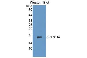 Detection of Recombinant MMP3, Human using Monoclonal Antibody to Matrix Metalloproteinase 3 (MMP3) (MMP3 抗体  (AA 363-477))