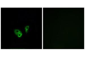 Immunofluorescence analysis of A549 cells, using CNGA2 antibody. (CNGA2 抗体  (Internal Region))