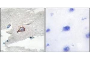 Immunohistochemistry (IHC) image for anti-Hemopoietic Cell Kinase (HCK) (AA 381-430) antibody (ABIN2888843) (HCK 抗体  (AA 381-430))