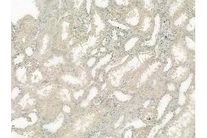 ABIN6257066 and ABIN6275007 at 1/100 staining human normal kidney tissue by IHC-P.