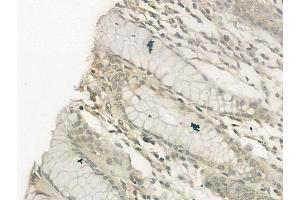 ABIN6257469 and ABIN6274751 at 1/100 staining human normal gastric tissue by IHC-P. (RPS19 抗体  (Internal Region))