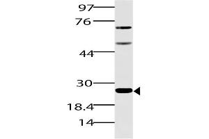 Image no. 1 for anti-Spi-B Transcription Factor (Spi-1/PU.1 Related) (SPIB) (AA 50-260) antibody (ABIN5027543) (SPIB 抗体  (AA 50-260))