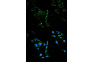 Immunofluorescence analysis of U2OS cells using MVP antibody. (MVP 抗体)