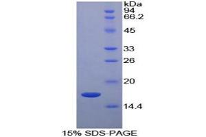SDS-PAGE analysis of Cow RBP5 Protein. (Retinol Binding Protein 5 蛋白)