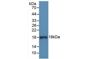 Detection of Recombinant C1INH, Human using Monoclonal Antibody to Complement 1 Inhibitor (C1INH) (SERPING1 抗体  (AA 399-500))