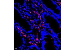 Immunofluorescence of paraffin embedded human colon using P4H (ABIN7074215) at dilution of 1:700 (400x lens) (HIF Prolyl Hydroxylase 抗体)