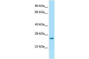 WB Suggested Anti-Hprt Antibody Titration: 1. (HPRT1 抗体  (C-Term))
