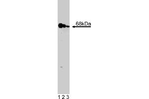 Western Blotting (WB) image for anti-Eukaryotic Translation Initiation Factor 2-alpha Kinase 2 (EIF2AK2) (AA 117-250) antibody (ABIN968165) (EIF2AK2 抗体  (AA 117-250))