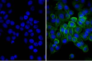Human pancreatic carcinoma cell line MIA PaCa-2 was stained with Mouse Anti-Human CD44-UNLB and DAPI. (驴 anti-小鼠 IgG (Heavy & Light Chain) Antibody (FITC))